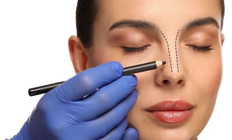 رینوپلاستی چیست ؟