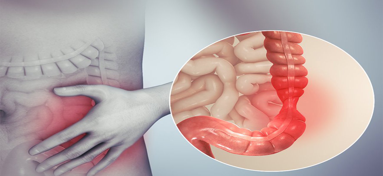 جراحی رکتوم