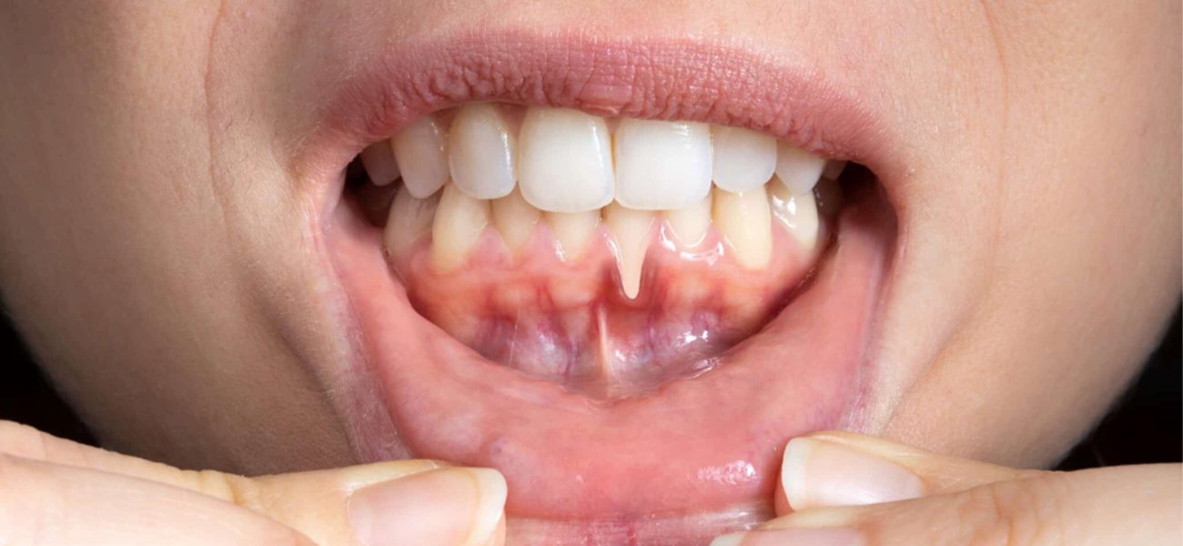 متخصص پریودنتیست