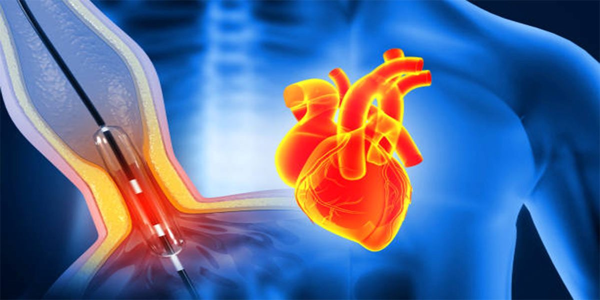 کدام درد قلب خطرناک است ؟