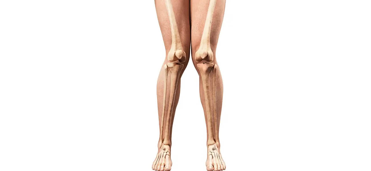 جراحی زانوی ضربدری