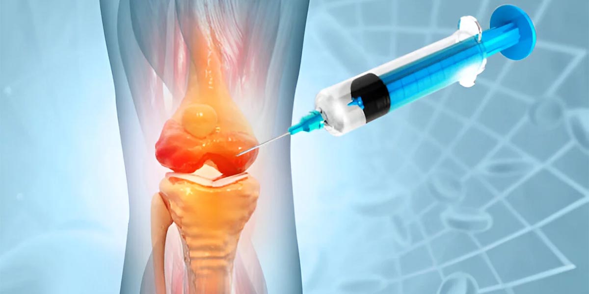 تزریق ژل به زانو