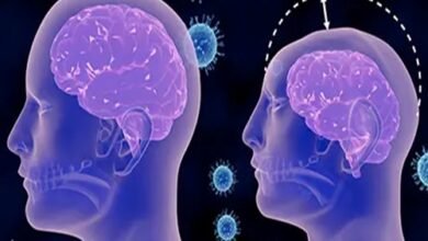 عمر کودکان میکروسفالی چقدر است؟