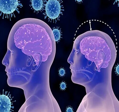 عمر کودکان میکروسفالی چقدر است؟