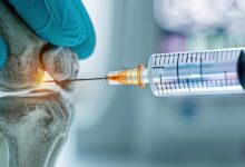 تزریق ژل به زانو