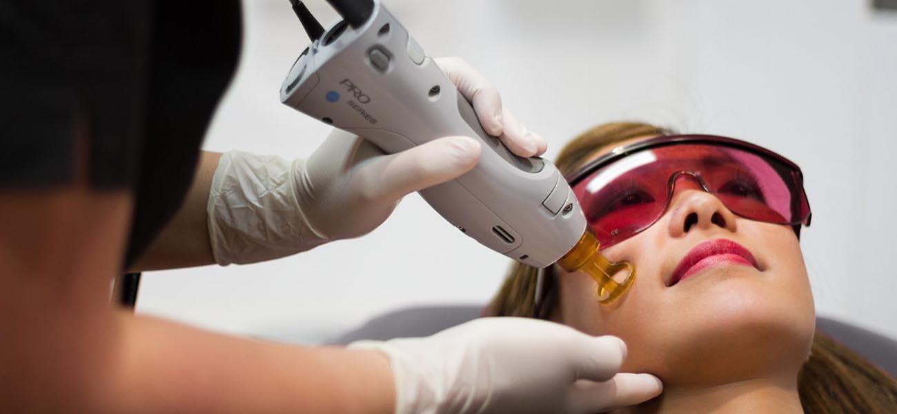 لیزر موهای زائد