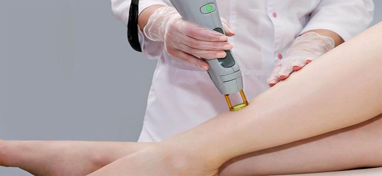 لیزر موهای زائد