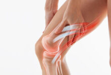 پارگی مینیسک زانو