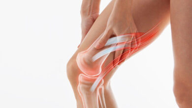 پارگی مینیسک زانو