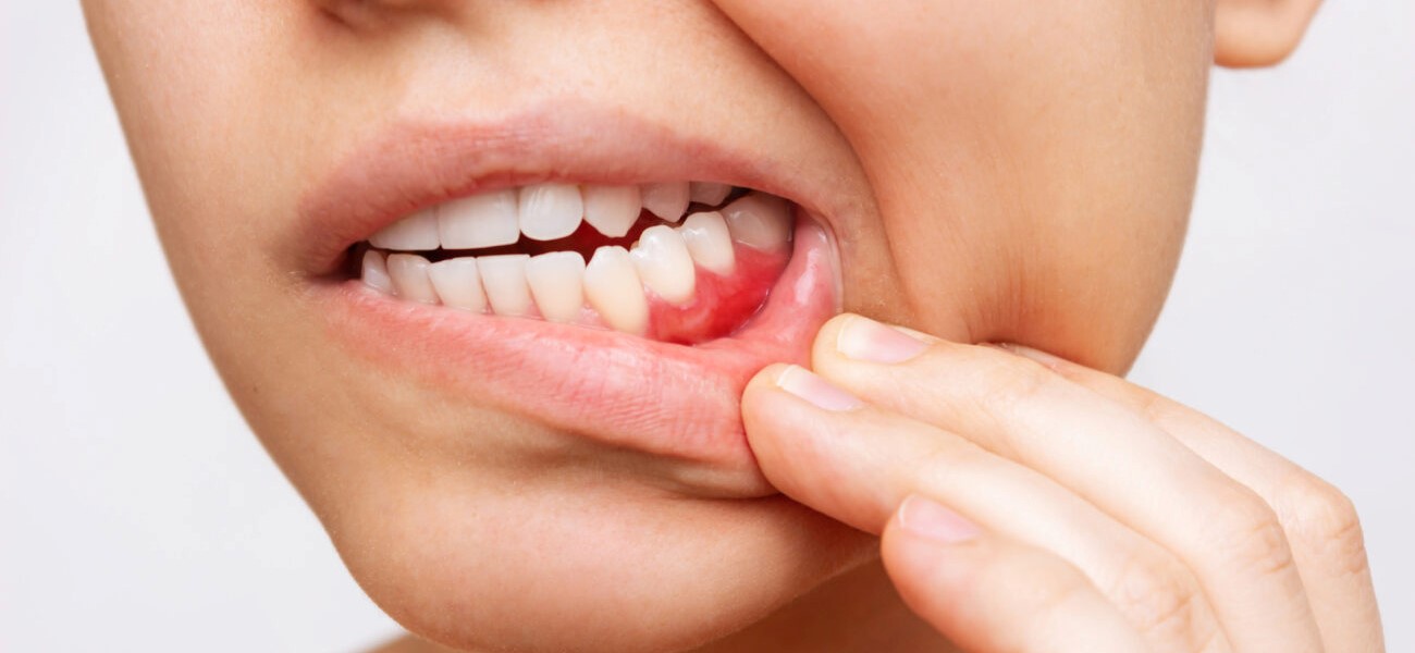 متخصص پریودنتیست