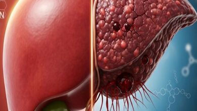 مبتلایان به کبد چرب، سبزیجات چلیپایی بخورند!