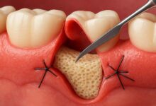 متخصص پریودنتیست