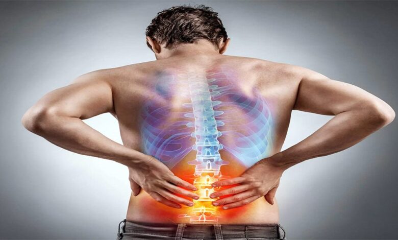 درمان غیر جراحی دیسک کمر