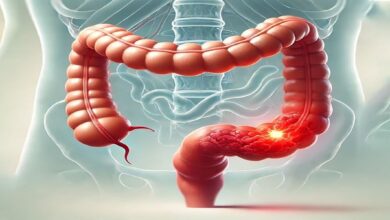 جراحی رکتوم