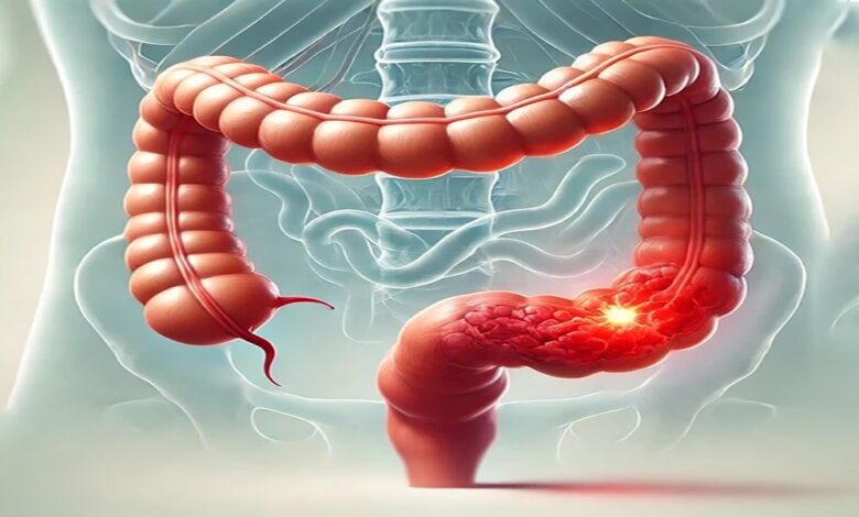 جراحی رکتوم