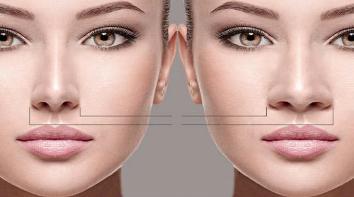 جراحی بینی گوشتی